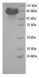 SDS-PAGE (LGR5-1441H).jpg
